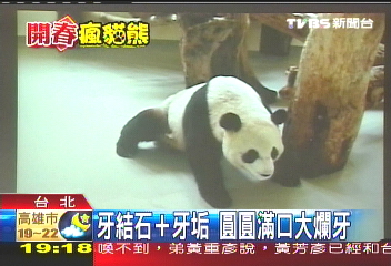牙結石+牙垢　圓圓滿口大爛牙