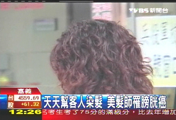 天天幫客人染髮 美髮師罹膀胱癌