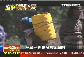 【目擊衣索匹亞】醫療欠完備 衣國病童待救助