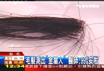 毛髮測出「金屬人」 醫師:99%安啦