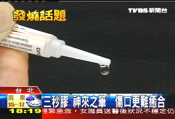 三秒膠「神來之筆」 傷口更難癒合