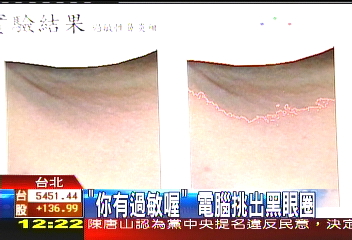 「你有過敏喔」　電腦挑出黑眼圈