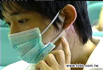 切除臉頰淋巴瘤 大四男找回自我