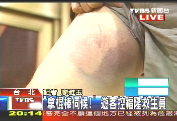 「鐵條伺候」　遊客控福隆救生員動粗