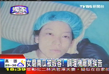 〈獨家〉女磨南瓜被毀容! 調理機廠商挨告