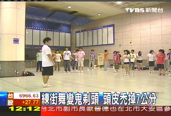 練街舞變鬼剃頭 頭皮禿掉7公分