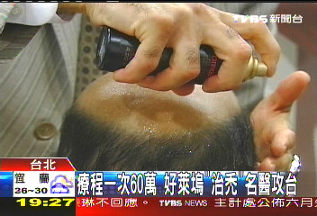 療程一次60萬　好萊塢「治禿」名醫攻台