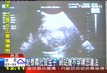 攬不孕婦赴泰借腹生子 業者恐觸法