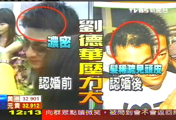 華仔前額髮稀疏　疑壓力大鬼剃頭