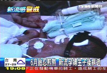 爲6月胎忍煎熬 新流孕婦生子後病逝