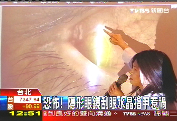 恐怖! 隱形眼鏡刮眼水晶指甲惹禍