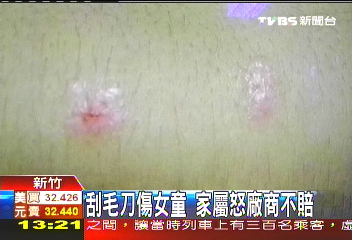 刮毛刀傷女童　家屬怒廠商不道歉