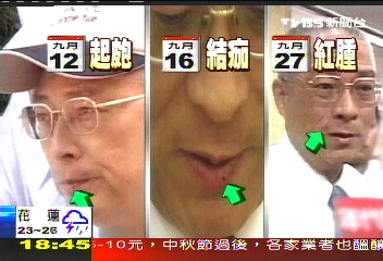 〈獨家〉吳揆操勞嘴巴破又腫　夫人忙抓藥