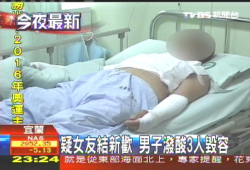 疑女友結新歡　男子潑酸3人毀容