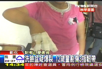 臉盆疑爆裂 12歲童割傷3手指韌帶