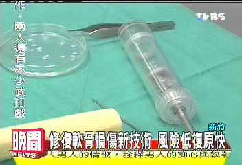 修復軟骨損傷新技術 風險低復原快