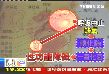 打呼致陽痿! 德研究「男」當心
