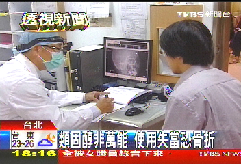 類固醇非萬能 使用失當恐骨折
