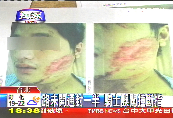 〈獨家〉路未開通封一半 騎士誤闖撞斷指