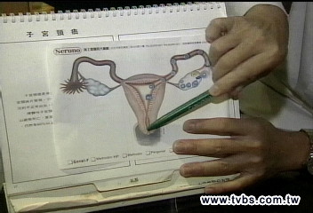 打完子宮頸疫苗憂鬱 女申請國賠