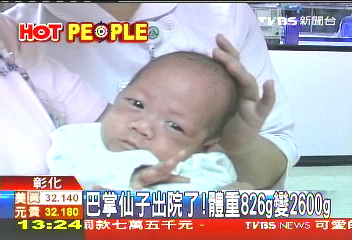 巴掌仙子出院了! 體重826g變2600g