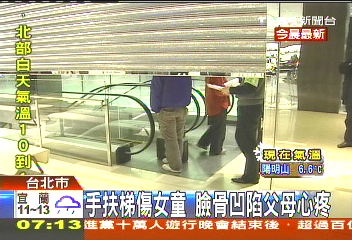 電扶梯又夾頭！　10歲女童臉骨凹陷