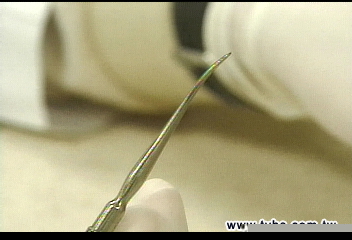 訓實習醫師誤傷手指 辣妹牙醫挨告