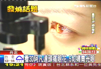 看3D阿凡達頭痛眼花 5旬婦青光眼