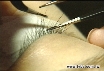 「睫毛沒了」!愛美種睫毛 害女毛囊受損