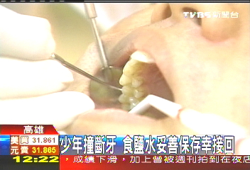 少年撞斷牙　食鹽水妥善保存幸接回