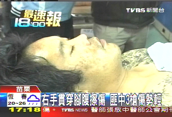 襲警匪手腳腹中3槍 警戒護轉診