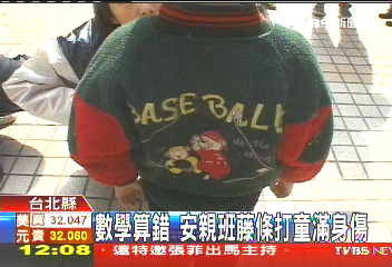 數學算錯 安親班藤條打童滿身傷
