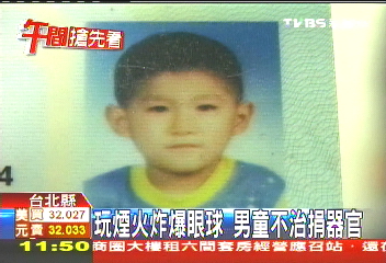 玩煙火炸爆眼球　男童不治捐器官