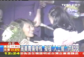 周美青傷脊椎擬植「人工骨」？　府駁斥