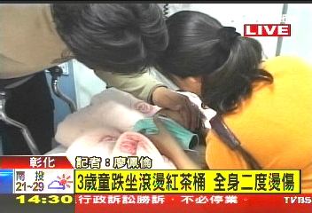 〈快訊〉3歲童跌坐滾燙紅茶桶 全身二度燙傷
