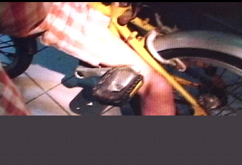 腳卡單車踏板 10歲童痛得哇哇叫