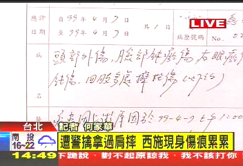 傷痕累累！　檳榔西施含淚控警暴力
