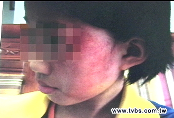 數學題不會 小4女遭狂打十餘巴掌