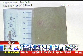 鑽子怪客!老婦遭襲 鑽子插背深2公分