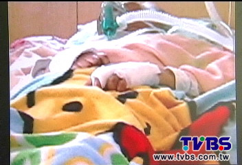 老婦手背潰爛　家屬控醫院點滴疏忽