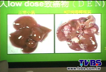 咖哩、薑萃取化合物　抗肝癌新契機！