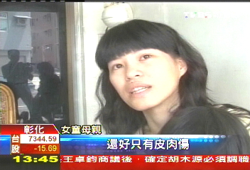 大陸玩具再出包　女童手指皮開
