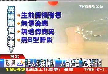 洋人死後捐肋　「人骨隆鼻」空姐不怕