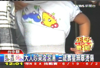 大人吵架潑滾湯 3歲壽星無辜燙傷