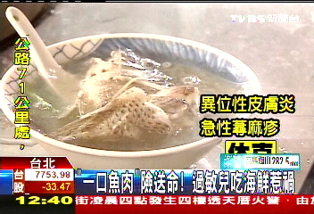 「一口魚肉」險送命! 過敏兒吃海鮮惹禍