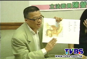 當兵體檢誤切睪丸? 軍醫遭控疏失