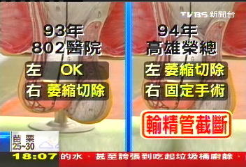 〈獨家〉蛋蛋不見了! 當兵體檢誤切睪丸?