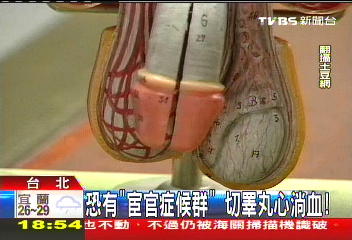 恐有「宦官症候群」 切睪丸心淌血
