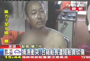 捕漁衝突! 台籍船長遭陸船員砍傷