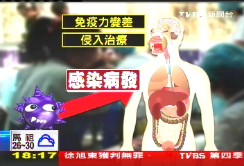 超級細菌「日」現蹤! 台將列法定全面監控